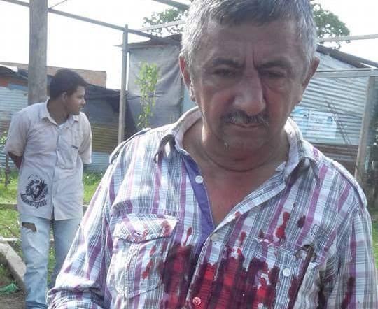  Candidato a Edil le rompió la nariz a aspirante al Concejo de Arauca
