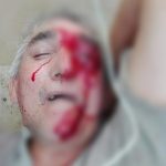  Cuatro campesinos resultaron heridos en enfrentamientos con la policía en el complejo petrolero de Caño Limón